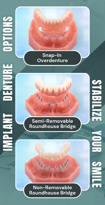 Implant Denture Options in Huntsville, AL | Free Implant Consultations