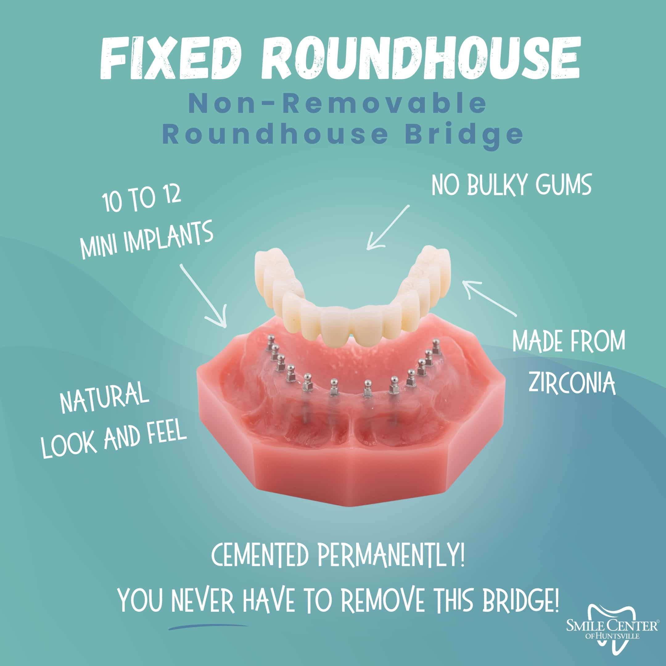 Permanent Fixed Bridge in Huntsville, AL